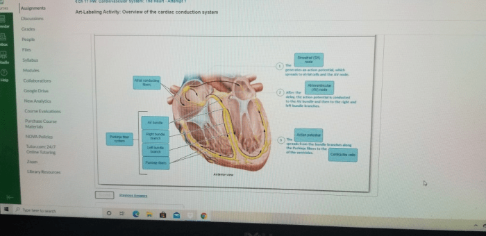 Art-labeling activity: overview of the digestive system